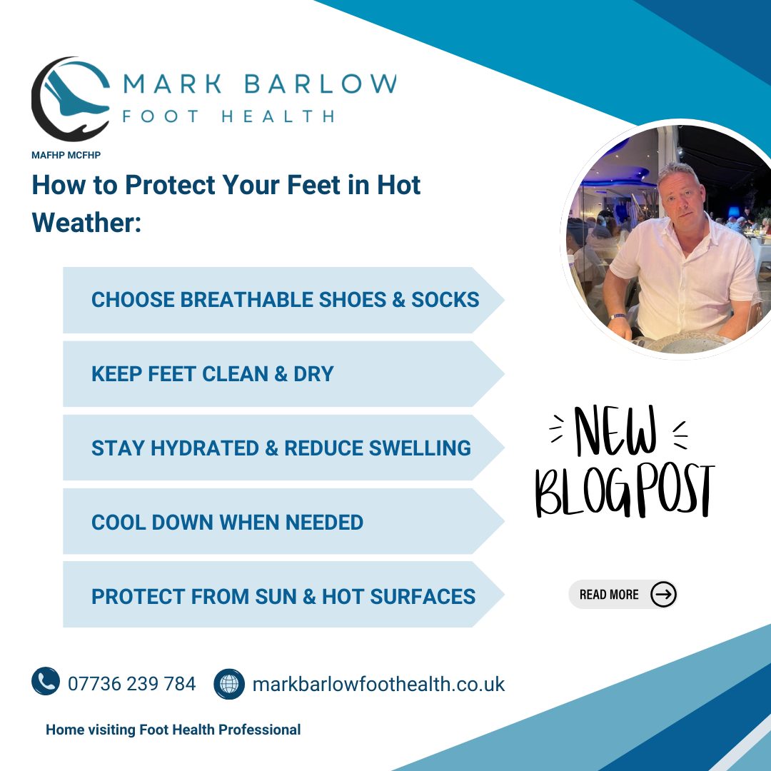 How to Protect your feet in hot weather